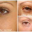 Patricinha Esperta5 105x105 - Quando a Maquiagem Causa Inflamação Nos Olhos...