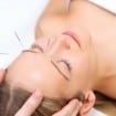 acupuntura 105x105 - Acupuntura elimina rugas e tira manchas do rosto
