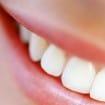 fluor 105x105 - Qual a importância do flúor nos dentes?