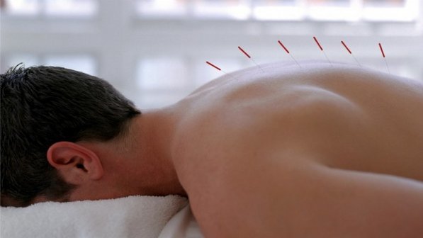 lombalgia costas acupuntura tratamento 20120319 size 598 - Acupuntura: Agulhinhas do Bem!