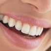 sensibilidade dentes 105x105 - Como acabar com a sensibilidade nos dentes?