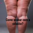 varicose veins closeup fat female cellulite legs picture id849084986 105x105 - Celulite Nas Pernas Tratamentos! ✅ O Guia Completo