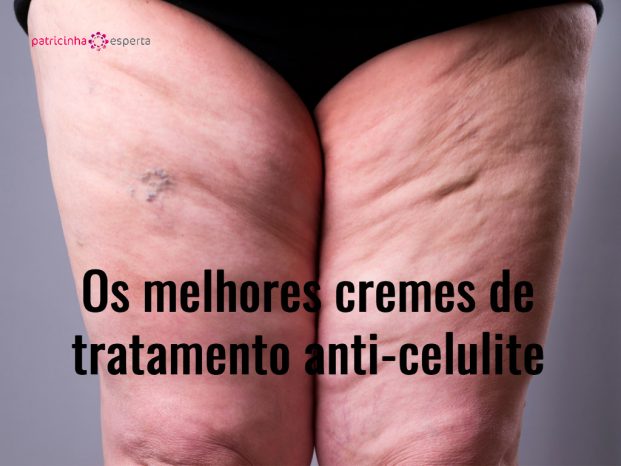 varicose veins closeup thick female legs picture id541269778 621x466 - Celulite Nas Pernas Tratamentos! ✅ O Guia Completo