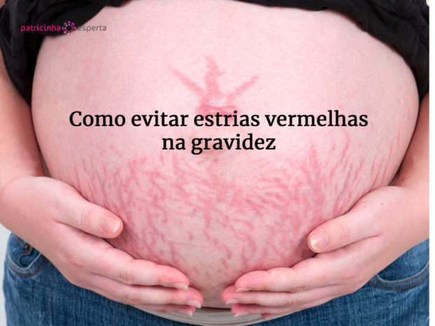 pregnant woman holding her stomach and stretch marks picture id93088746 621x466 - Estrias Vermelhas: Como tirar?