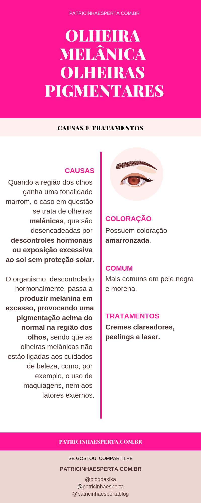 olheiras pigmentares - Como Tirar Olheiras - Tratamentos, Receitas Caseiras, Causas, Vídeos